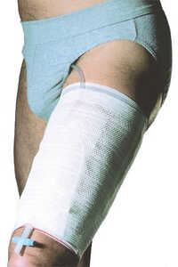 Benfixering Leggyfix 10st